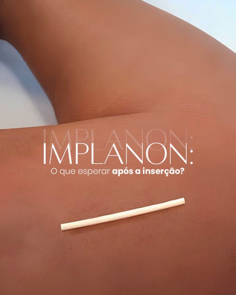 Implanon: O que esperar após a inserção?